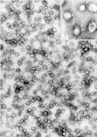 vesicles electron micrograph vesicle synaptic negative purified staining rat brain peter courtesy shows dr introduction pharmacology2000 pharmacology autonomics