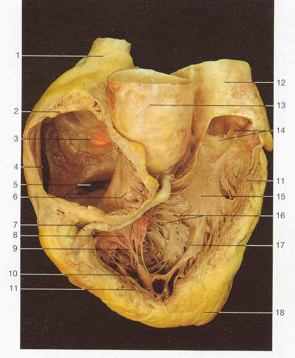 right_heart1.jpg