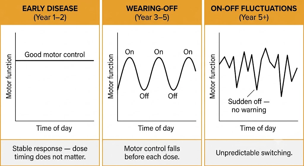 Three-panel line graph showing progression from stable motor function in early disease, to predictable wearing-off waves in years three to five, to unpredictable on-off fluctuations after year five.